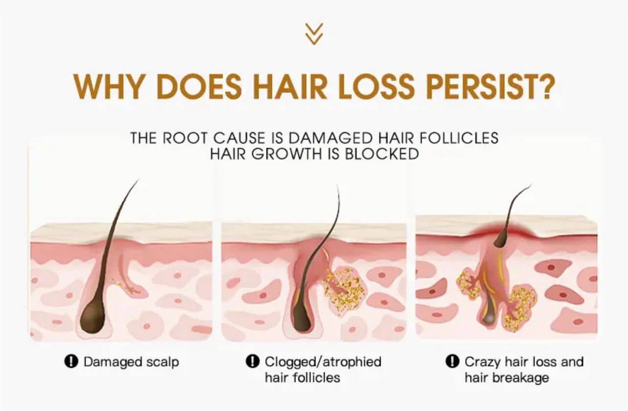 Natural Rosemary Oil | Anti-Hair Loss