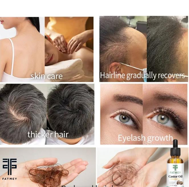 Huile de Ricin Noire Jamaïcaine