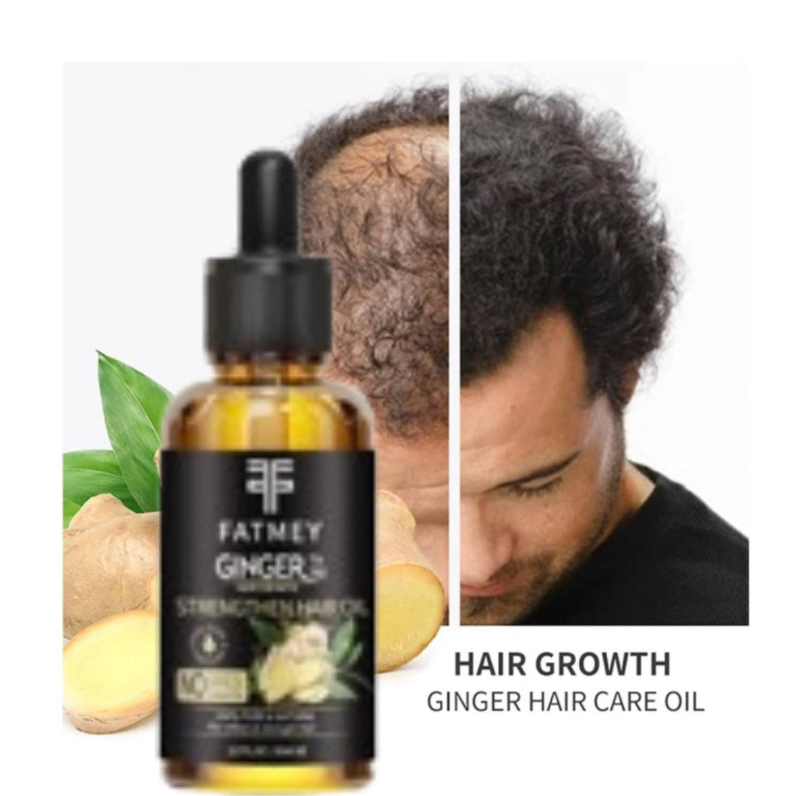 Ginger Oil for Hair Growth and Strengthening