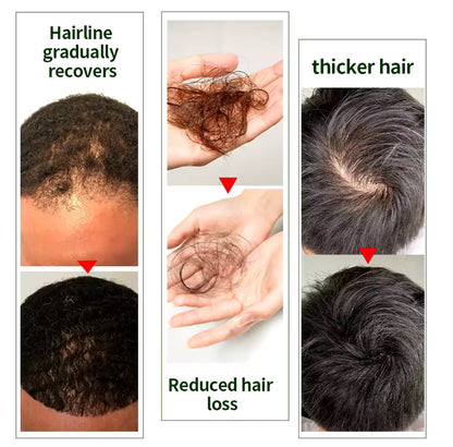 Ginger Oil for Hair Growth and Strengthening