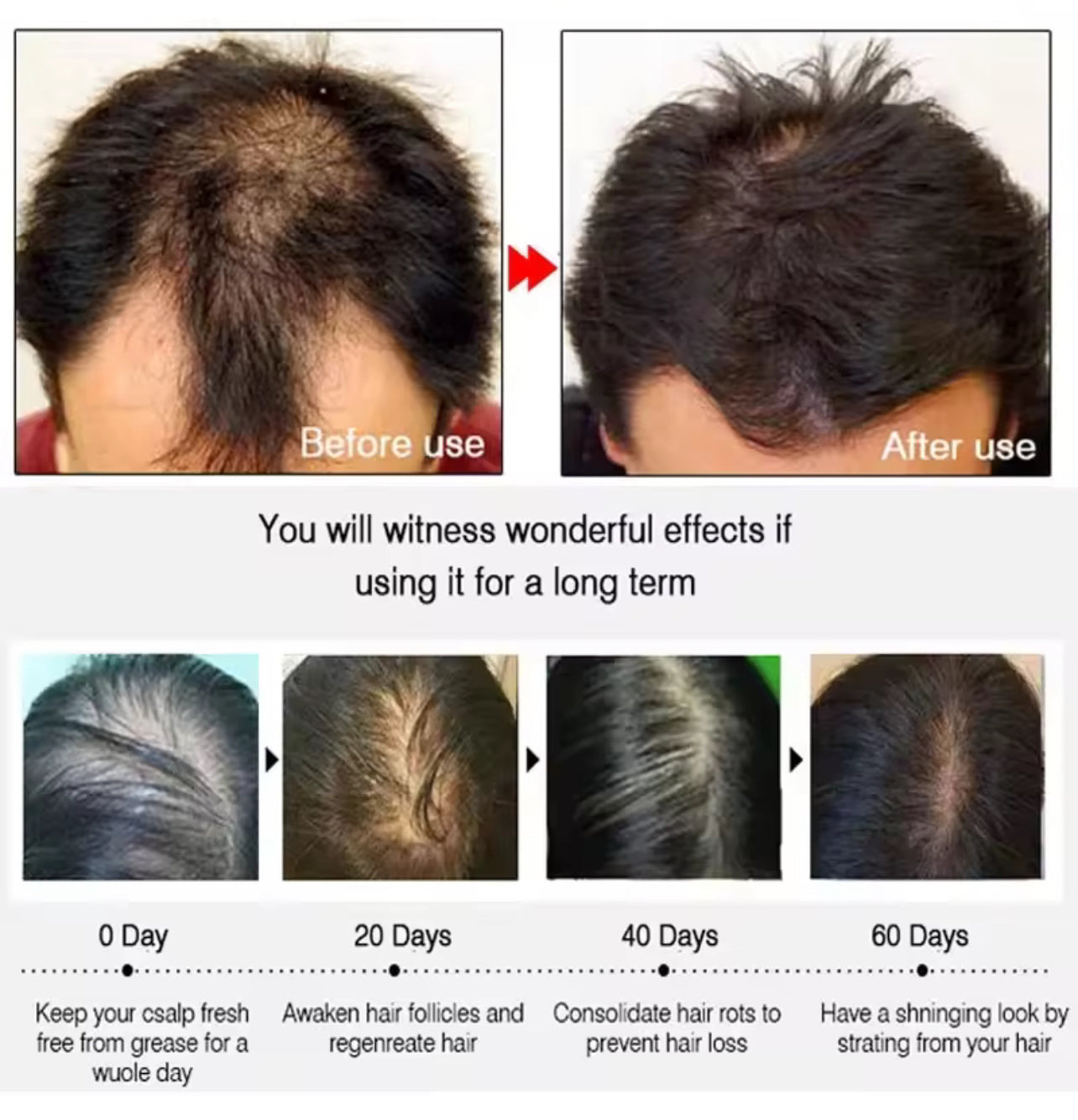 Ginger Oil for Hair Growth and Strengthening