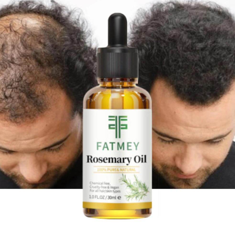 Natural Rosemary Oil | Anti-Hair Loss