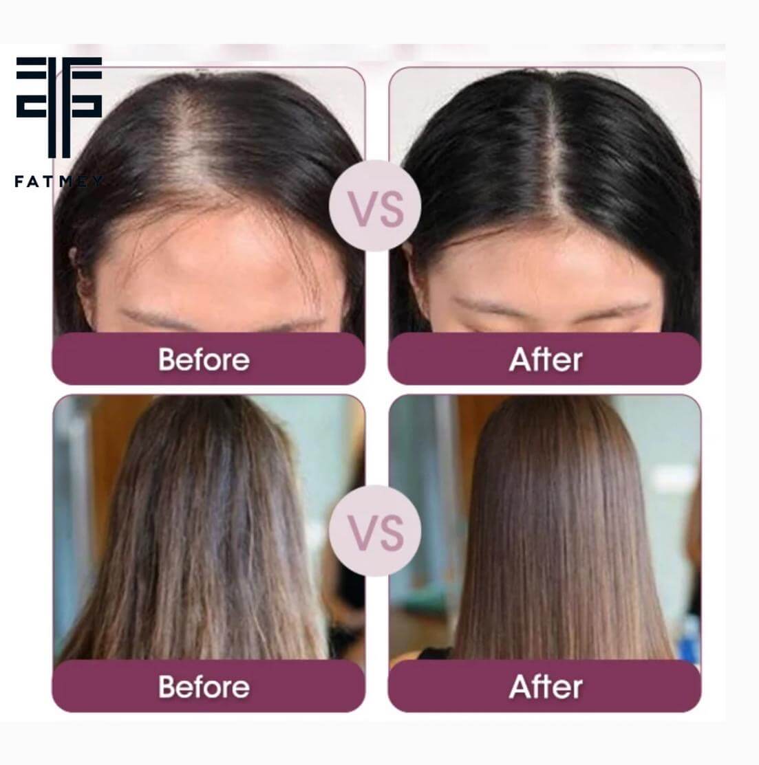 Red Onion Thickening Oil for Hair Growth