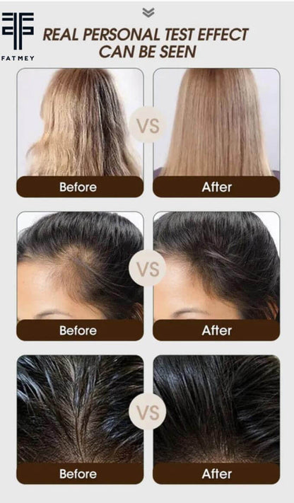 Gamme Anti-Chute:Gingembre et Arbre à Thé