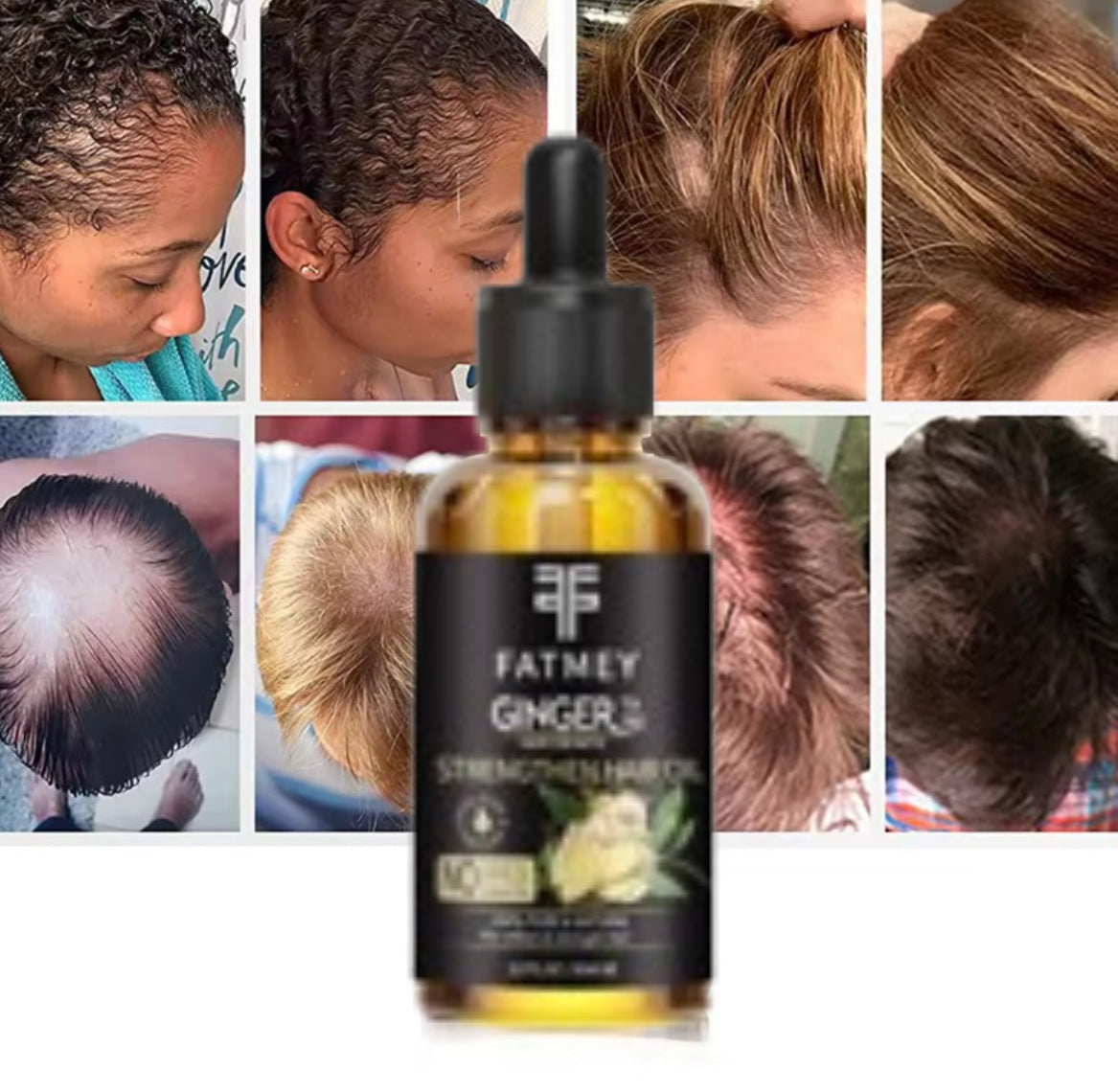 Ginger Oil for Hair Growth and Strengthening