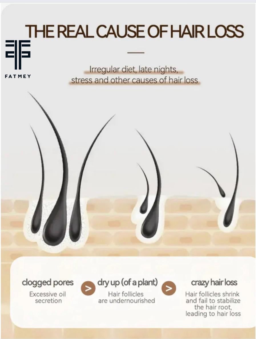 Ginger Oil for Hair Growth and Strengthening