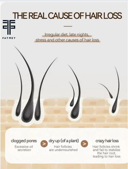 Ginger Oil for Hair Growth and Strengthening