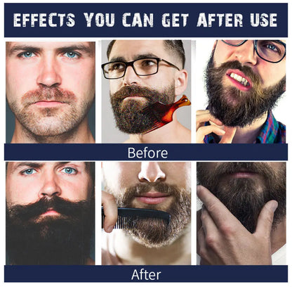 Beard Balm – Intense Care and Natural Conditioning