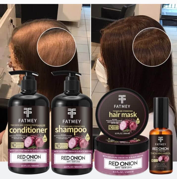 Gamme Fortifiante à l’Oignon Rouge et Graine Noire