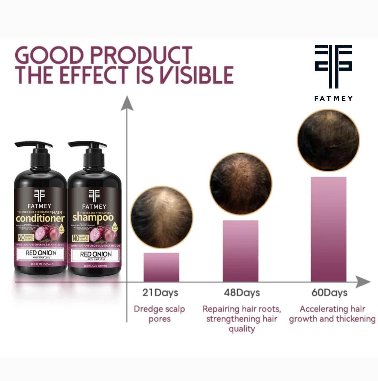 Gamme Fortifiante à l’Oignon Rouge et Graine Noire